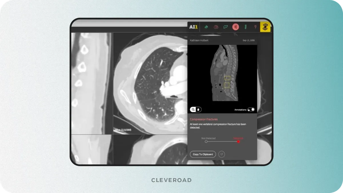 Healthcare AI automation